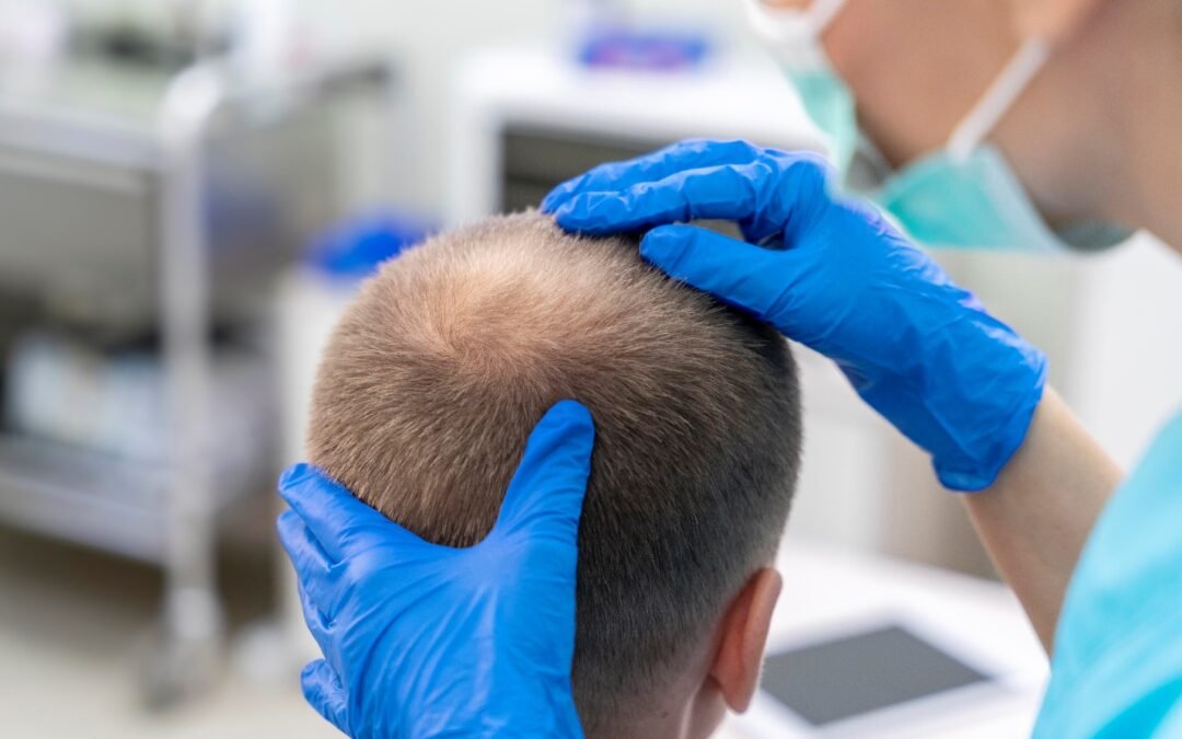 Une greffe de cheveux peut vous donner des résultats permanents et naturels